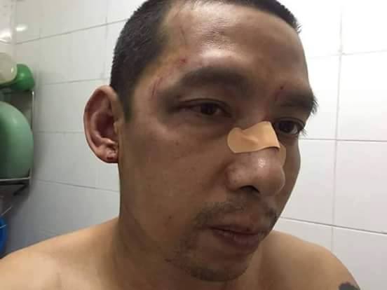 Nhà hoạt động dân sự Lã Việt Dũng bị 4 kẻ lạ mặt đánh thương tích khi đến tham dự phiên xử (ảnh: facebook Van Hai Nguyen)