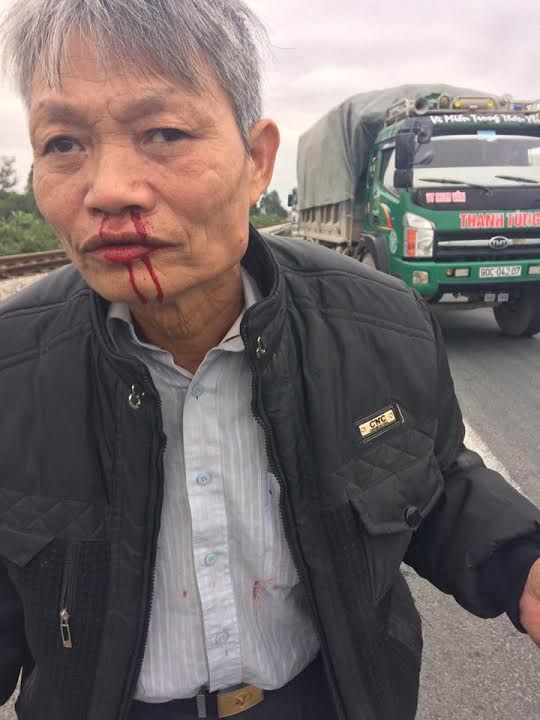 Ông Trương Minh Hương bị thương tích sau khi bị hành hung dã man (ảnh; Facebook Ha Huy Son)